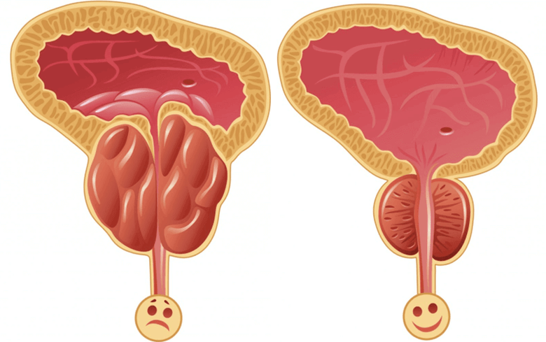 potenciaproblémák okai férfiaknál